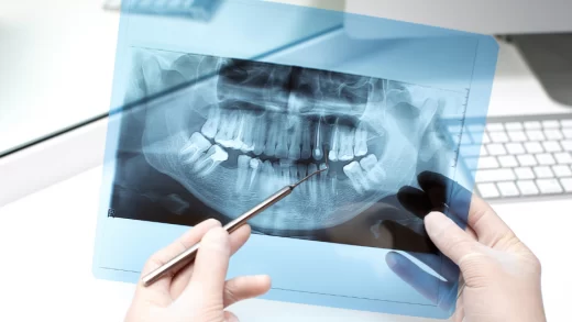 Foto-de-uma-pessoa-com-uma-Foto-de-uma-radiologia-odontológica